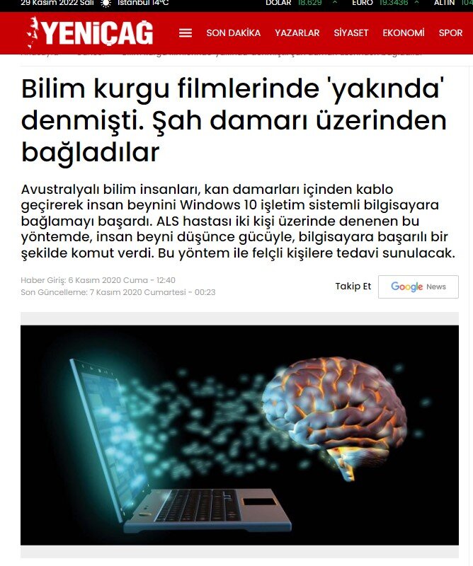 insan beyni bilgisayara bağlandı gazete alıntı fotoğraf